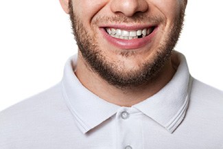 A smiling adult man with a missing tooth