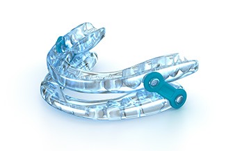 Light blue oral appliance