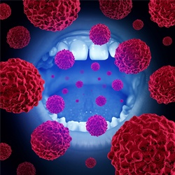 oral cancer