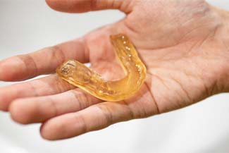 Hand holding a mouthguard for bruxism