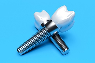 Two single tooth dental implants on blue background