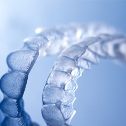 clear aligners