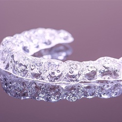 Invisalign aligner