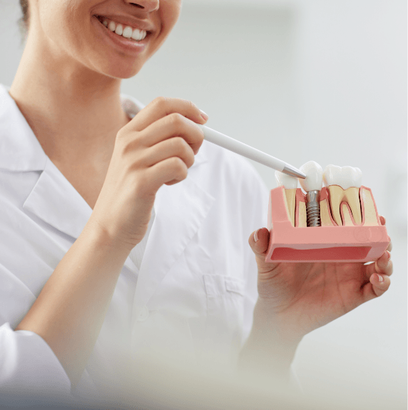dental implant diagram