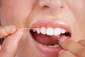 Follow your dentist’s aftercare instructions for best results after scaling and root planing