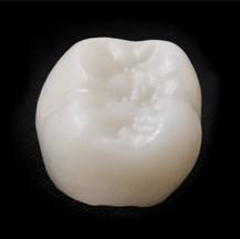 dental crown