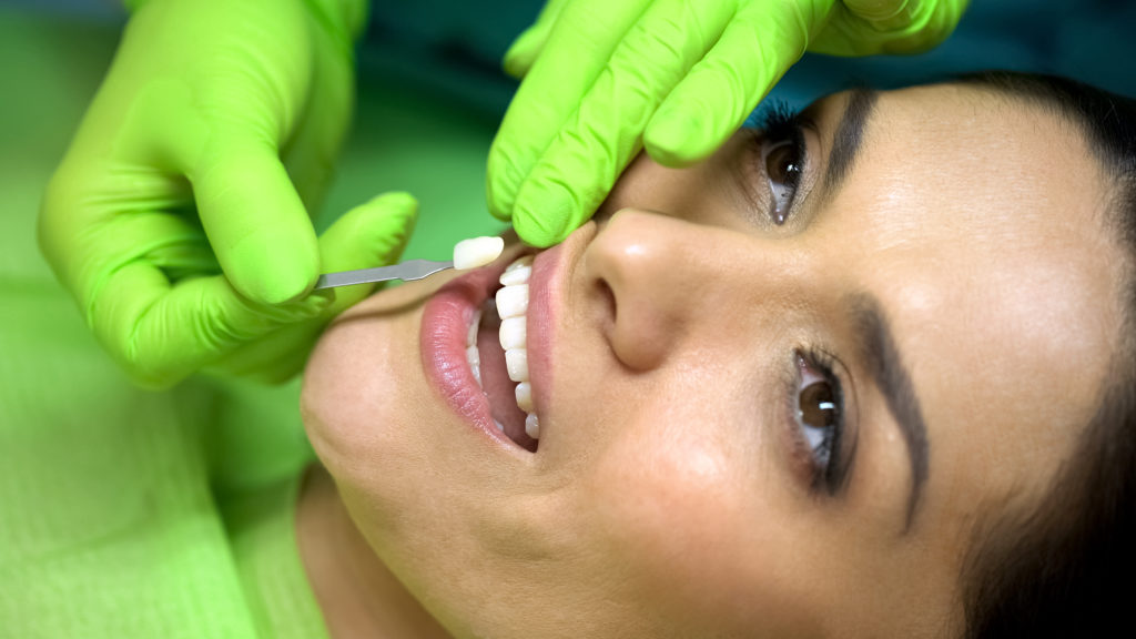 Woman getting porcelain veneers in Melbourne