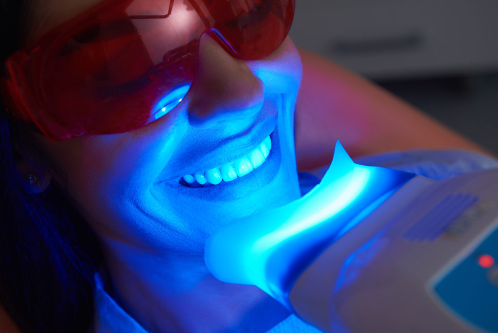 A woman doing a teeth whitening treatment