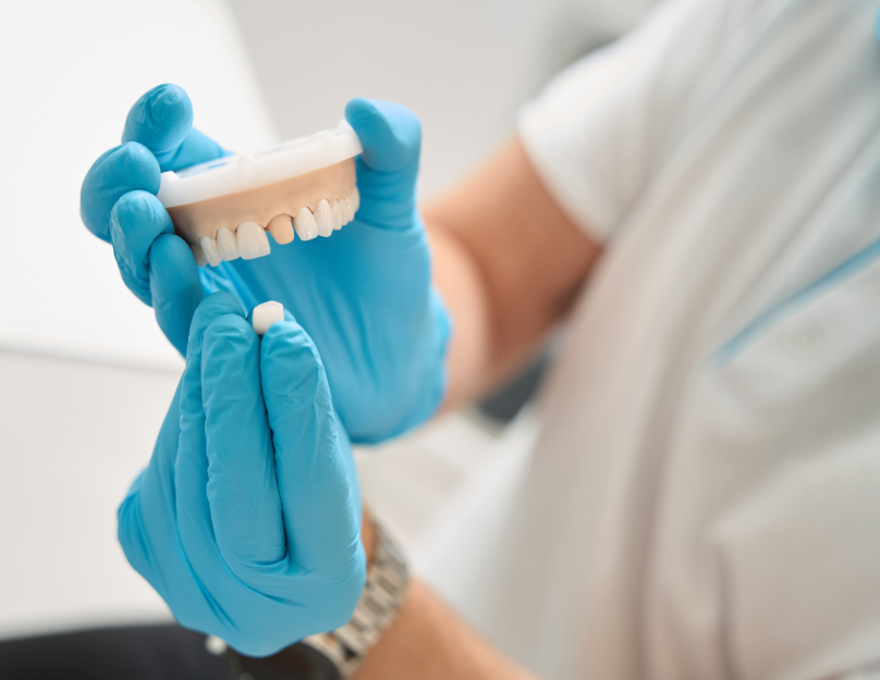 Model of dental crown