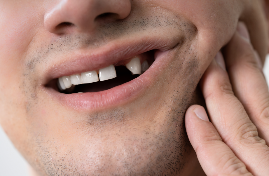 Close up of man's mouth with missing tooth