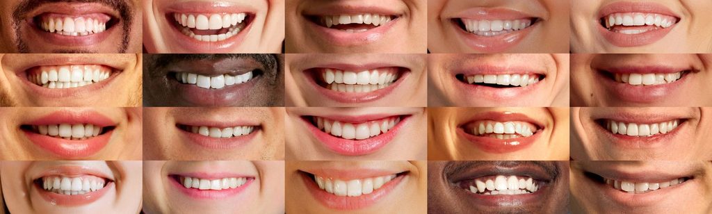 A collage of different people’s smiles.